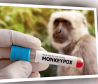 Phát hiện các ca bệnh đậu mùa khỉ đầu tiên