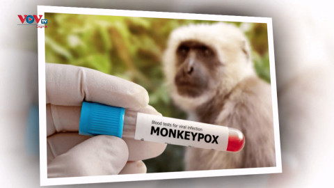Phát hiện các ca bệnh đậu mùa khỉ đầu tiên