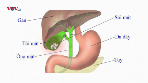 Talk: Bệnh sỏi mật và phương pháp điều trị