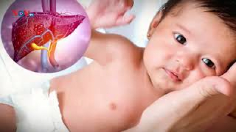 Viêm gan ở trẻ: Biện pháp phòng bệnh